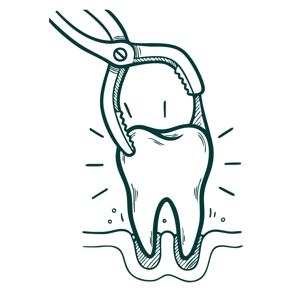 drawing of a tooth being extracted